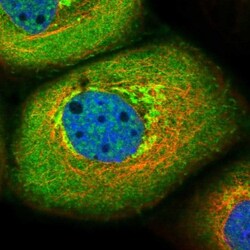 Roquin Antibody, Novus Biologicals 0.1mL; Unlabeled:Antibodies, Polyclonal